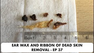 RIBBON OF DEAD SKIN AND EAR WAX REMOVAL  EP 37 [upl. by Eiral]