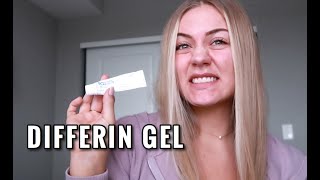 WHY I STOPPED USING DIFFERIN GEL [upl. by Martelle587]