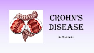 Crohns disease  vs ulcerative colitis extraintestinal manifestation investigation treatment [upl. by Tnomyar]