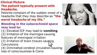 Subarachnoid Hemorrhage [upl. by Relyuc]