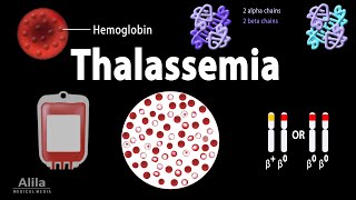 Thalassemia Alpha amp BetaThalassemias Genetics Pathophysiology Diagnosis amp Treatment Animation [upl. by Rhea]