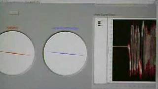 Comparision Complementary Filters vs Kalman Filter vs Extended Kalman Filter [upl. by Allain]