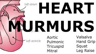 Systolic murmurs diastolic murmurs and extra heart sounds  Part 2  NCLEXRN  Khan Academy [upl. by Ardnuasak93]