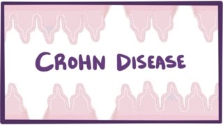 Crohns disease Crohn disease  causes symptoms amp pathology [upl. by Nivled]