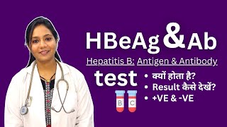 HBeAg and Antibodies Test in Hindi  Positive Negative Result Analysis [upl. by Llednar]