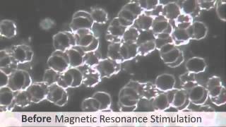 dark field microscopy before and after imrs PEMF treatment [upl. by Zebada]