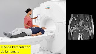 Imagerie par résonance magnétique IRM de larticulation de la hanche [upl. by Leroy852]