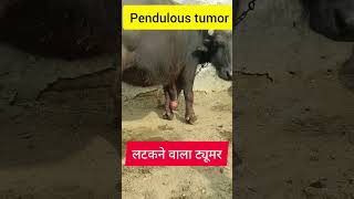 pendulous tumor l Dr Umar Khan [upl. by Atnwahsal705]