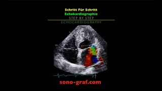 Echokardiographie  Schritt Für Schritt [upl. by Tisbe]