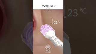 Transform and Glow✨ with Forma V InMode🌸Vive Plastic Surgery tijuana [upl. by Codel]