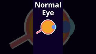 Eye  Anatomy Function  Normal [upl. by Wendelina]