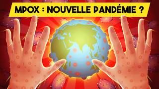 MPOX  La PROCHAINE pandémie   Variole du singe  Monkeypox [upl. by Alethia]