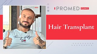 Hair Transplant [upl. by Odelia]