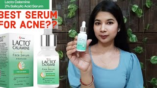 LACTO CALAMINE Face Serum ReviewBest Face Serum For Acne amp Pimples In IndiaBest Vit C Serum [upl. by Rehc]