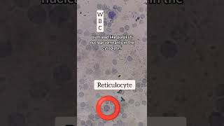 How to do microscopy and calculate reticulocyte count Reticulocyte count Part 2 [upl. by Hsur572]