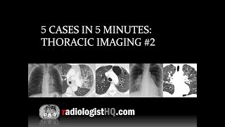 5 Cases in 5 Minutes Thoracic 2 [upl. by Imer876]