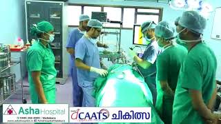 VADAKARA ASHA HOSPITAL dCAATS [upl. by Yedorb]