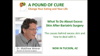 What to Do About Excess Skin After Bariatric Surgery [upl. by Shane]