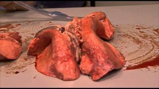 Lung inflation in HD video [upl. by Dionysus]