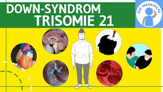 Down Syndrom  Trisomie 21  Definition Merkmale Ursachen amp Formen amp Unterscheidungen  Genetik [upl. by Navis]