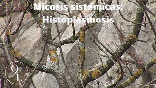 10 Micosis sistémicas Histoplasmosis [upl. by Elocel605]