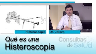 ¿Qué es una Histeroscopia  Ginecología  Dr Luis Diego Carazo [upl. by Belinda374]