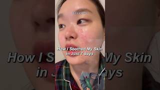 How I soothed my skin in ONLY 7 DAYS acneproneskincare koreanskincare skincareroutine [upl. by Thurmann]