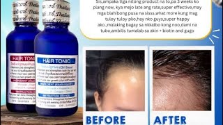 MINOXIDIL 15 hair Tonic  Product Review [upl. by Dlorej79]