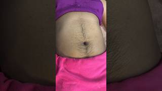 shortvideo Rica wax results after one monthRica wax benefitsskincare waxingtipsricawax waxing [upl. by Sokim39]