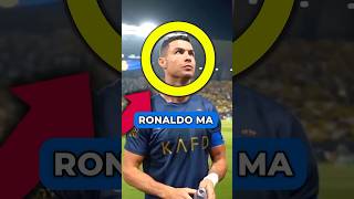 DLACZEGO RONALDO MA ZNISZCZONE PAZNOKCIE shorts [upl. by Octave]