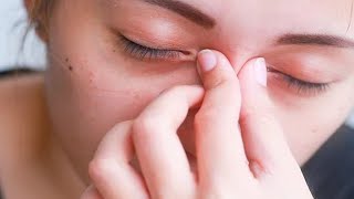 Home Remedies to Reduce Eye Swelling from Crying  Swollen eyes from crying  puffy eyes from crying [upl. by Adihaj502]