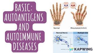 An introduction to autoimmune diseases I Autoimmunity I Immunotolerance I Antigens I Autoantigens I [upl. by Paolina]