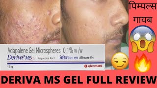 Deriva MS Gel Full review Effects and Side Effects Best for Acne Pimples पिम्पल्स गायब🔥😃👍🏻 [upl. by Refitsirhc]