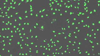 Time Lapse Imaging of BPAEC Cells Treated With Menadione [upl. by Cher]