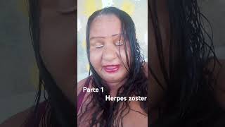 herpes zoster [upl. by Harmonia]