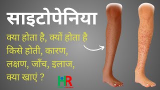 Drug induced immune cytopenia  साइटोपेनिया क्या है साइटोपेनियाके कारण साइटोपेनिया का इलाज [upl. by Etireugram542]