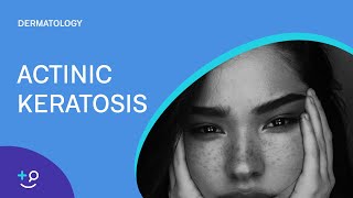 Actinic Keratosis Dermatology [upl. by Nerol926]