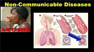 Noncommunicable Diseases [upl. by Esirec]