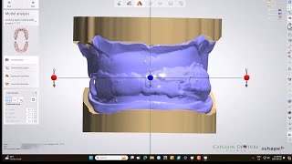 CUDCLD Design with 3D Biteplate [upl. by Anitsirk]