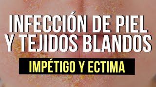 Infección de piel y tejidos blandos 🦠  Impétigo y ectima [upl. by Ellebana412]