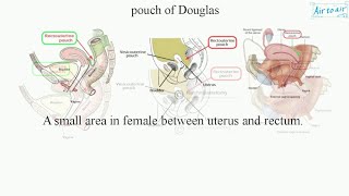 Anatomy and Clinical anatomy of Pouch of Douglas Rectouterine pouch Rectovesical pouch [upl. by Assennav]