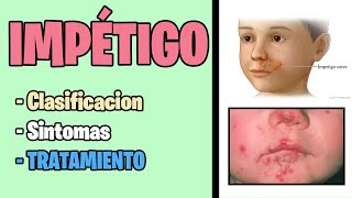 Infeccion bacteriana en la piel IMPÉTIGO Que es fisiopatologia y Tratamiento  Piodermitis [upl. by Sergent]