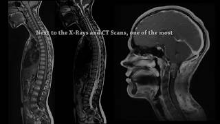 Gadolinium Contrast Awareness [upl. by Munsey]