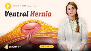 Ventral Hernia  General Surgery Video Lecture  Doctors VLearning  sqadiacom [upl. by Baram]