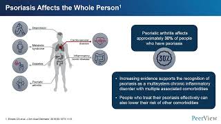 Staying on Target Against Moderate to Severe Psoriasis [upl. by Neelyhtak316]