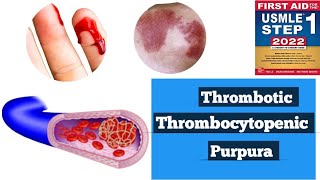 Thrombotic thrombocytopenic purpura TTPHUS Hematology lacturesDoctors goal [upl. by Graves]