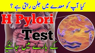 H PYLORI Test Kiya Hai  Diagnosis amp Prevention  Explain In Detail [upl. by Georg]