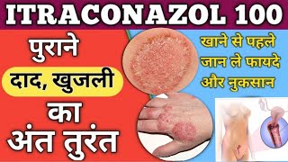 Itraconazole Capsule 200100mgitratek Capsule Use Dose Side Effects and Price in Hindi [upl. by Ferrick791]