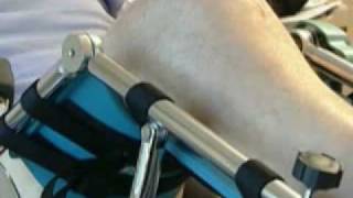 CPM for the Knee  Continuous Passive Motion Machine [upl. by Malan]