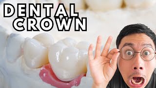 Dental Crown Procedure Animation EXPLAINED [upl. by Tristam]